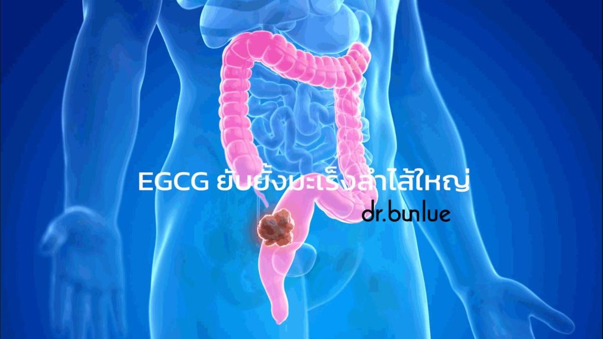 EGCG ยับยั้งมะเร็งลำไส้ใหญ่