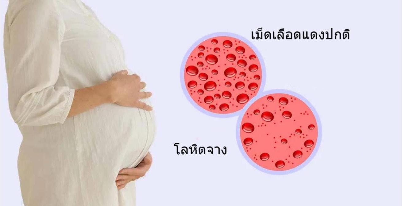 ระดับ NAD+ มีผลต่อความเสี่ยงที่จะเกิดโรคโลหิตจาง