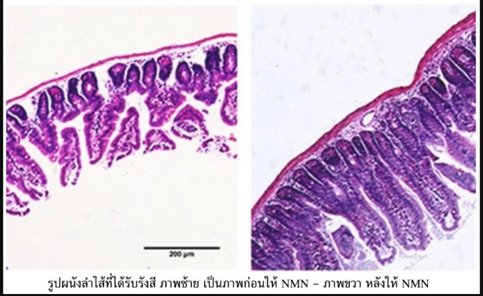 NMN ช่วยปกป้องเซลล์ผนังลำไส้จากการฉายรังสี!