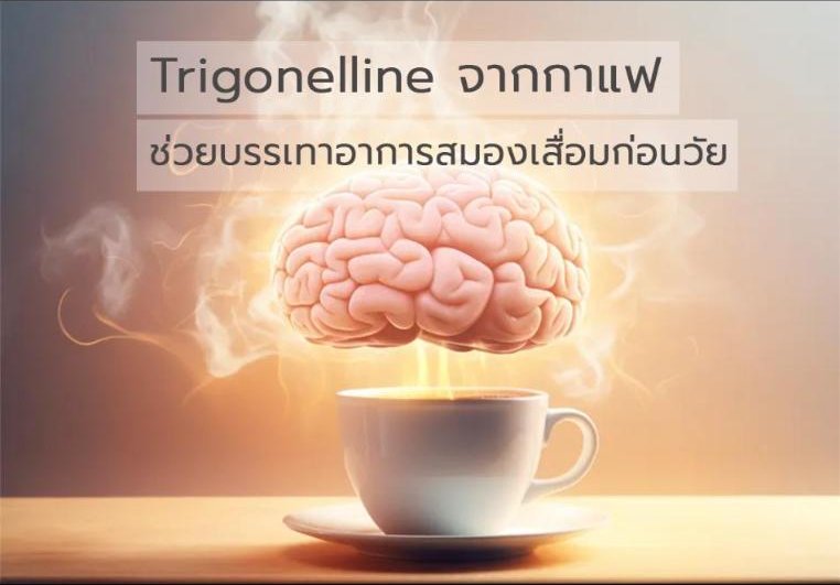 Trigonelline จากกาแฟช่วยบรรเทาอาการสมองเสื่อมก่อนวัย