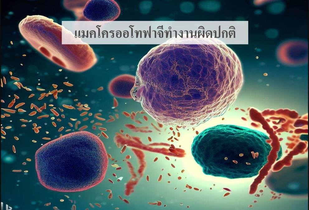 ทำไมเราถึงแก่ชรา? (ตอนที่ 10/12) ... กลไกแมคโครออโทฟาจีทำงานผิดปกติ (Disabled Macroautophagy)