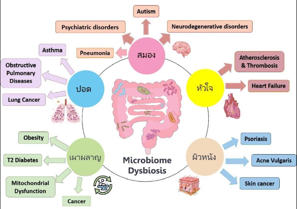 ทำไมเราถึงแก่ชรา? (ตอนที่ 12/12) ... การเสียสมดุลย์ของจุลินทรีย์ในร่างกาย (Microbiome Dysbiosis)
