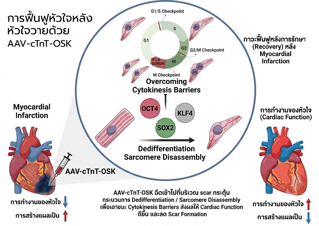 การฟื้นฟูหัวใจหลังหัวใจวายด้วย AAV-cTnT-OSK 